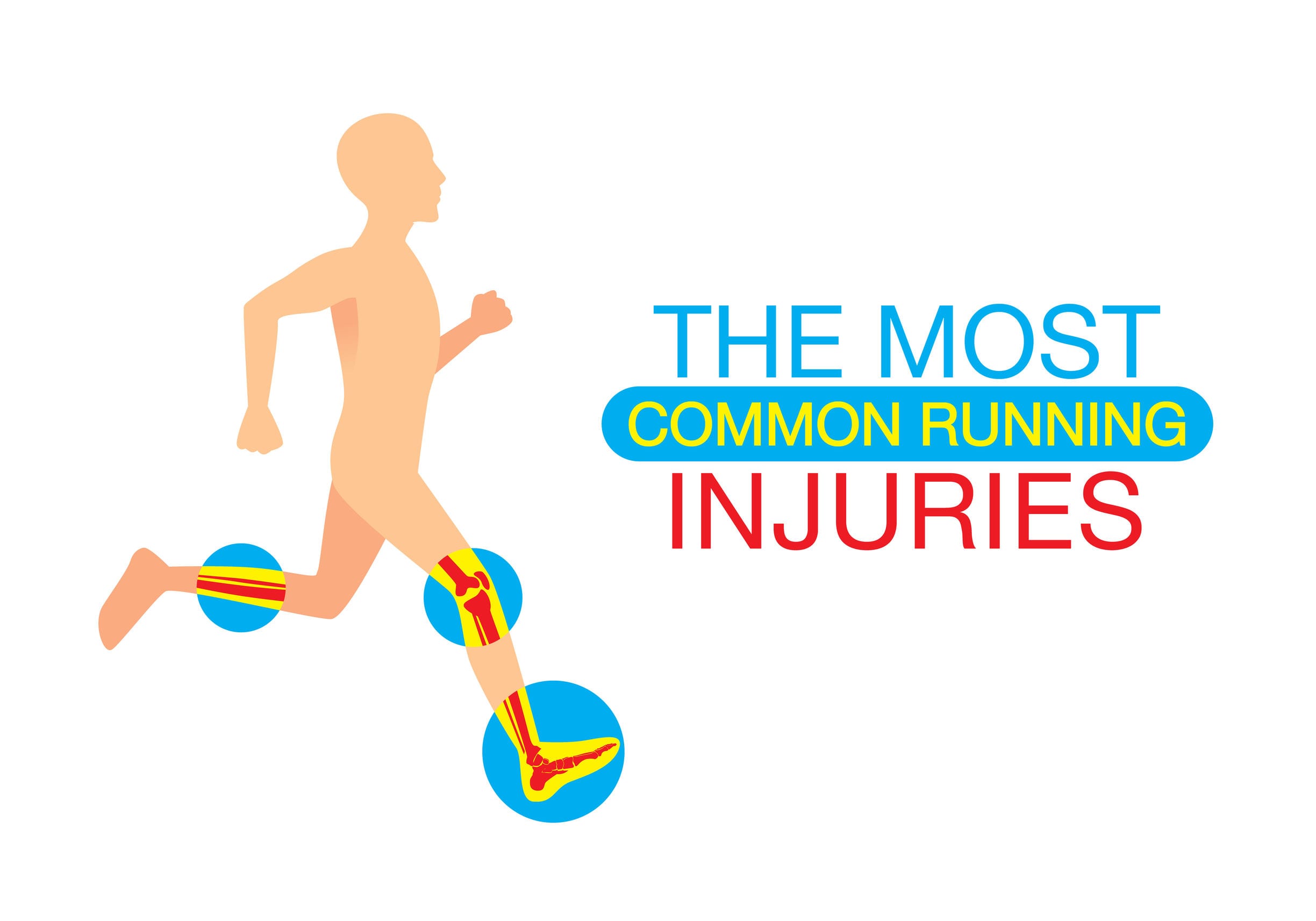 sports injury running